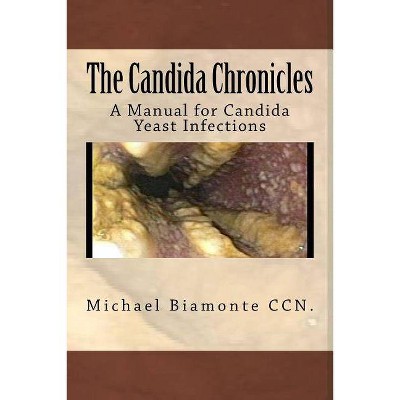 The Candida Chronicles - by  Michael C Biamonte Ccn (Paperback)