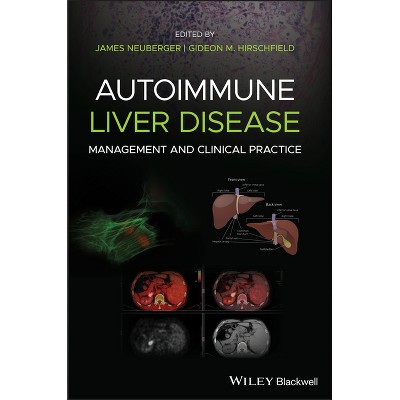 Autoimmune Liver Disease - by  James Neuberger & Gideon M Hirschfield (Hardcover)