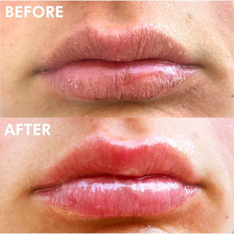 Lanolips Ultra Healing 101 Ointment Multi-Use Lip Balm - Strawberry - 0.35oz, 4 of 9