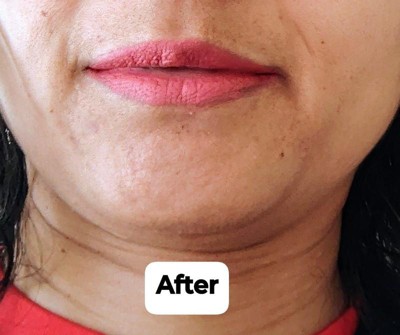 Guest review image 2 of 3, zoom in