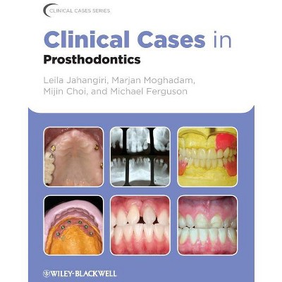 Clinical Cases in Prosthodontics - (Clinical Cases (Dentistry)) by  Leila Jahangiri & Marjan Moghadam & Mijin Choi & Michael Ferguson (Paperback)