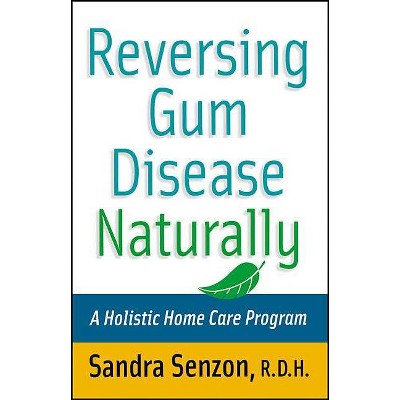 Reversing Gum Disease Naturally - by  Sandra Senzon & E Chronimed Zack (Paperback)