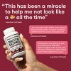 Physician's Choice Digestive Enzyme Probiotic Capsules - 30ct - 3 of 4