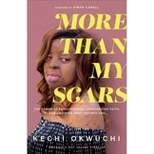 More Than My Scars - by Kechi Okwuchi
