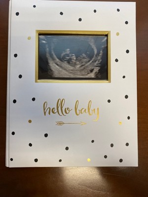 Pearhead Vintage Baby Memory Photo And Scrapbook Albums - Yellow : Target