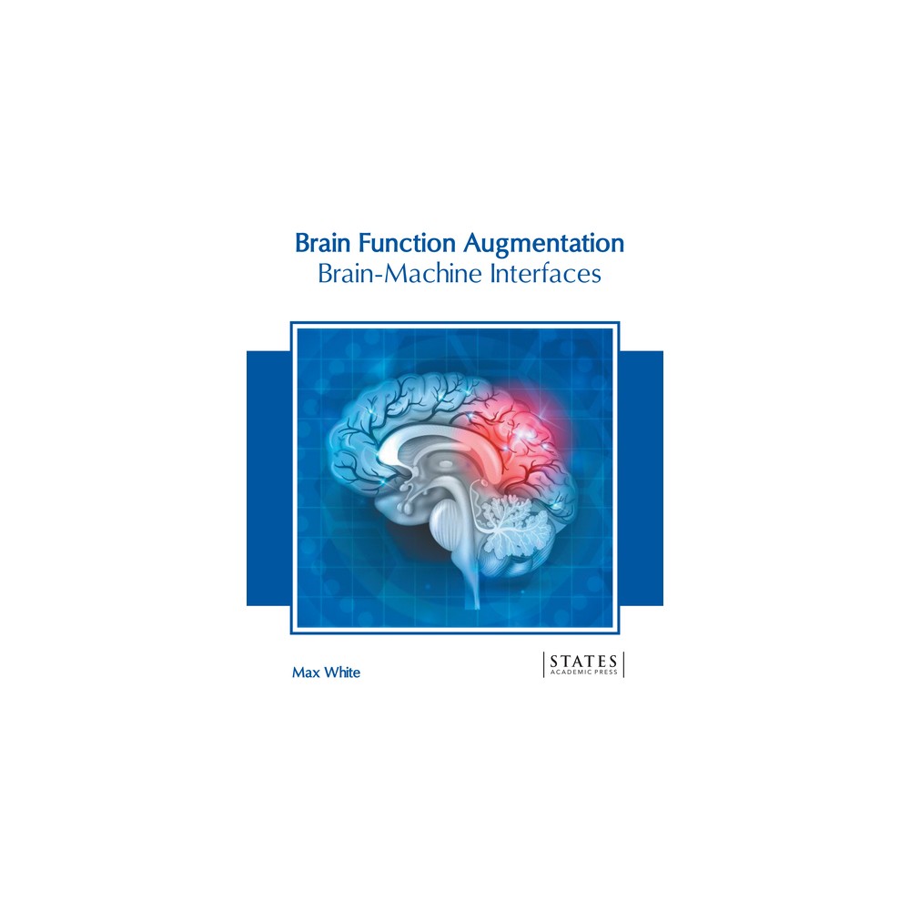 Brain Function Augmentation: Brain-Machine Interfaces - by Max White (Hardcover)