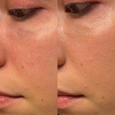 Guest review image 1 of 2, zoom in