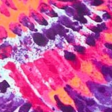 fiery tie dye