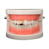 Unique Bargains Hip Hop Style Fake Teeth Grills 1 Set - 2 of 4