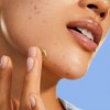 BYOMA Blemish Acne Treatment Pimple Paste - 0.5 fl oz - 2 of 4
