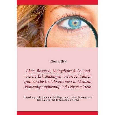 Akne, Rosacea, Morgellons & Co. und weitere Erkrankungen, verursacht durch synthetische Celluloseformen in Medizin, Nahrungsergänzung und