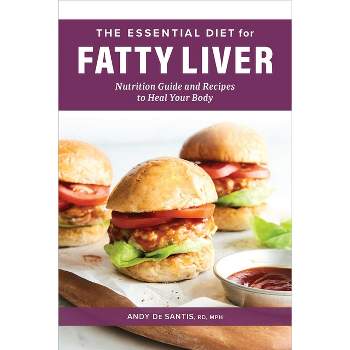 The Essential Diet for Fatty Liver - by  Andy de Santis (Paperback)