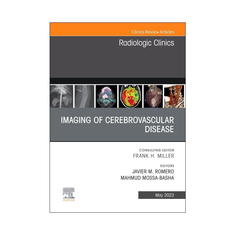 Imaging of Cerebrovascular Disease, an Issue of Radiologic Clinics of North America - (Clinics: Radiology) by  Javier M Romero & Mahmud Mossa-Basha, 1 of 2