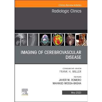 Imaging of Cerebrovascular Disease, an Issue of Radiologic Clinics of North America - (Clinics: Radiology) by  Javier M Romero & Mahmud Mossa-Basha