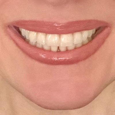 Guest review image 1 of 2, zoom in