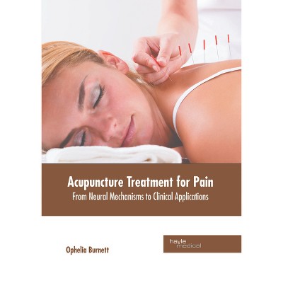Acupuncture Treatment for Pain: From Neural Mechanisms to Clinical Applications - by  Ophelia Burnett (Hardcover)
