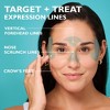 PETER THOMAS ROTH Peptide Skinjection Expression Line Hydra-Gel Patches - 60ct - Ulta Beauty - 3 of 4
