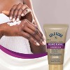Gold Bond Radiance Renewal Hand and Body Lotion - 2 of 4