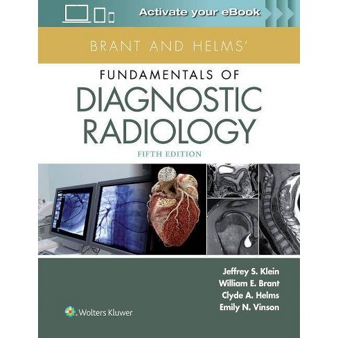 Brant And Helms Fundamentals Of Diagnostic Radiology 5th Edition By Jeffrey Klein Emily N Vinson William E Brant Clyde A Helms Hardcover Target - roblox gear codes of peiatrons youtu
