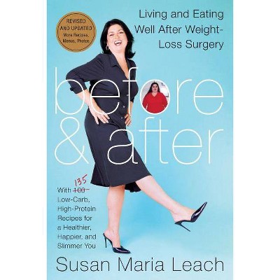 Before & After, Revised Edition - by  Susan Maria Leach (Paperback)