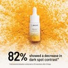 Dr. Brandt Bright This Way Dark Spots No More - Reduces Number, Intensity & Size of Pigmented Spots - 0.5 fl oz - 4 of 4
