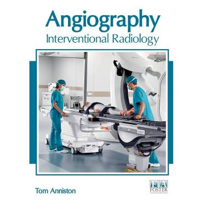 Angiography: Interventional Radiology - by  Tom Anniston (Hardcover)