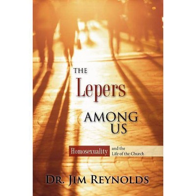 The Lepers Among Us - by  Jim Reynolds (Paperback)