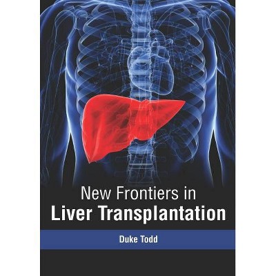 New Frontiers in Liver Transplantation - by  Duke Todd (Hardcover)