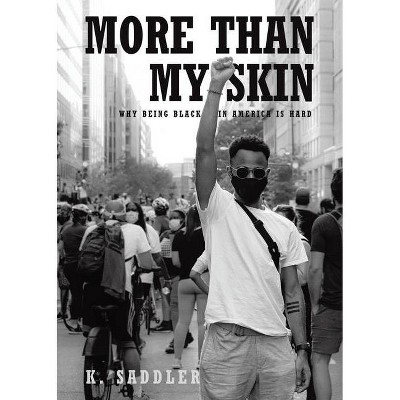 More Than My Skin - by  K Saddler (Paperback)