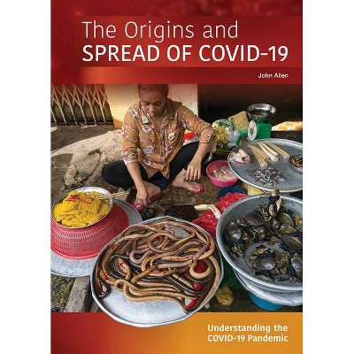 The Origins and Spread of Covid-19 - (Understanding the Covid-19 Pandemic) by  John Allen (Hardcover)