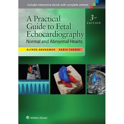 A Practical Guide to Fetal Echocardiography - 3rd Edition by  Alfred Z Abuhamad & Rabih Chaoui (Hardcover)