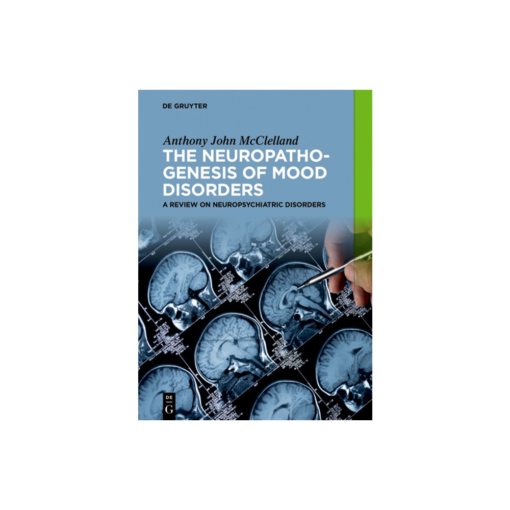 The Neuropathogenesis of Mood Disorders - by Anthony John McClelland (Paperback)