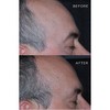 PHYTO RE30 Anti-Grey Hair Treatment Spray (1.69 oz) Anti-Gray Hair Action, Hair Pigmenting Technology - 2 of 4