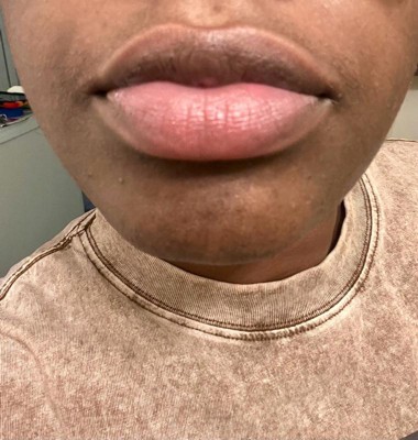 Guest review image 3 of 3, zoom in