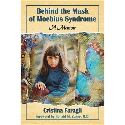 Behind the Mask of Moebius Syndrome - by  Cristina Faragli (Paperback)