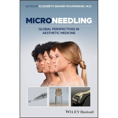 Microneedling - by  Elizabeth Bahar Houshmand (Hardcover)