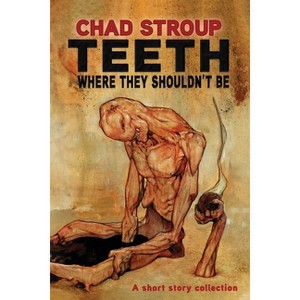 Teeth Where They Shouldn't Be - by  Chad Stroup & Oddness (Paperback) - 1 of 1