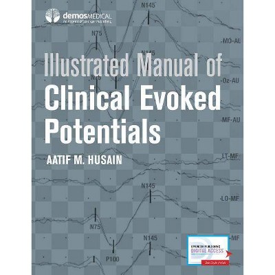 Illustrated Manual of Clinical Evoked Potentials - by  Aatif M Husain (Hardcover)