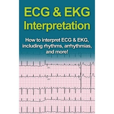 ECG & EKG Interpretation - by  Jeremy Pine (Paperback)