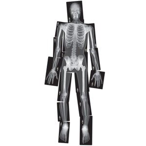 Royclo Human X-Rays on Film - 18 Pieces - 1 of 3