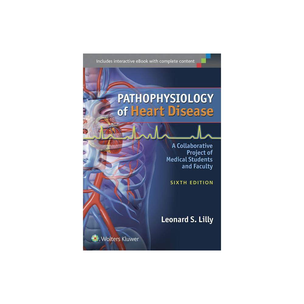 ISBN 9781451192759