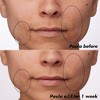 e.l.f. SKIN PLZ Clarify Facial Oil - 2% Salicylic Acid Acne Treatment + Aloe Extract - 1 fl oz - 3 of 4