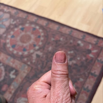 Guest review image 1 of 1, zoom in