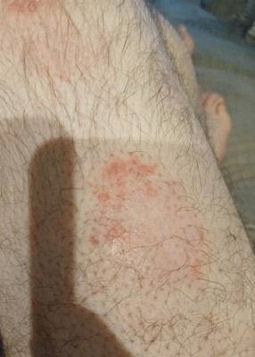 Guest review image 1 of 1, zoom in