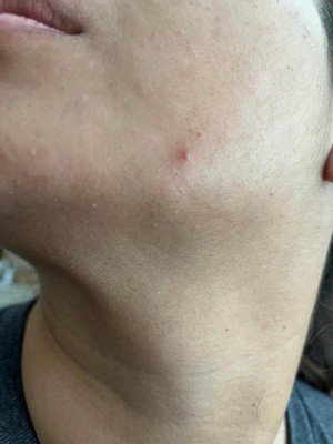 Guest review image 2 of 4, zoom in