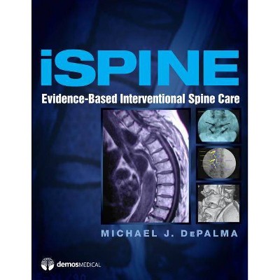 Ispine - by  Michael J Depalma (Hardcover)