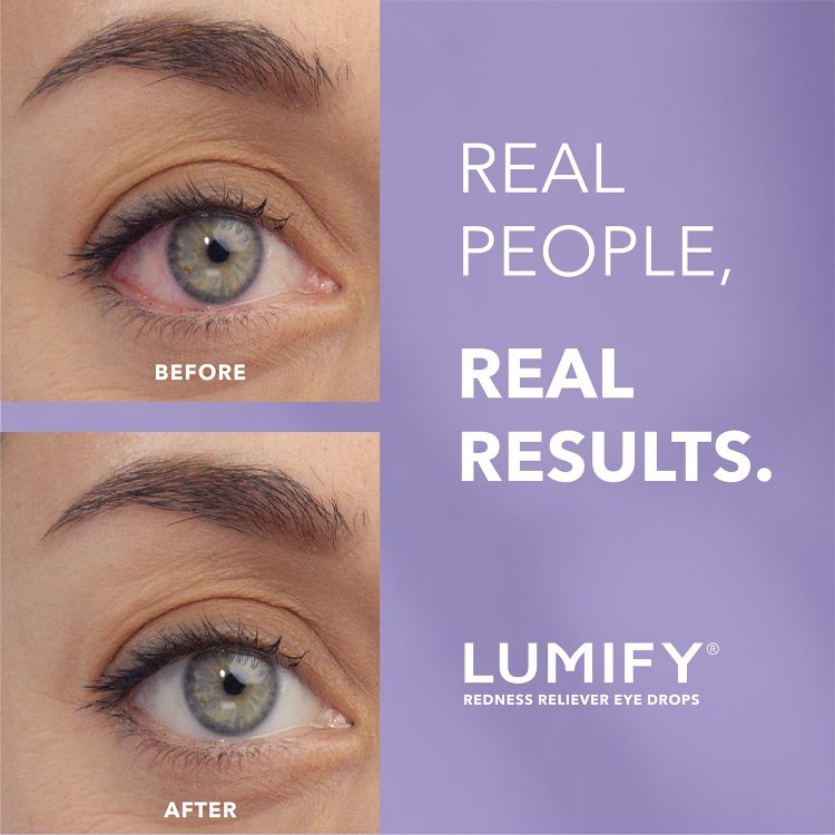 Lumify Eye Drops for Redness Relief - 7.5ml, 3 of 9