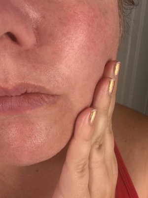 Guest review image 3 of 3, zoom in