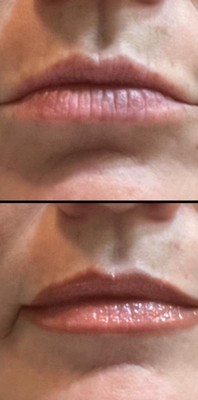 Guest review image 1 of 3, zoom in