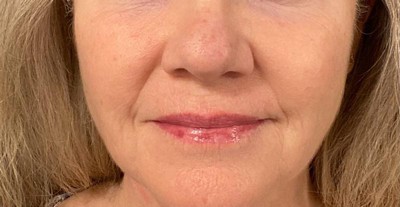 Guest review image 3 of 3, zoom in